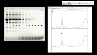 Celebrity Gel Analysis Wealth