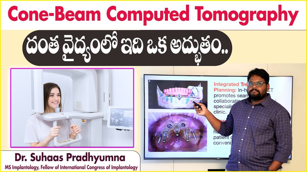 Importance Of CBCT in Dental Treatments || Cone Beam Computed ...