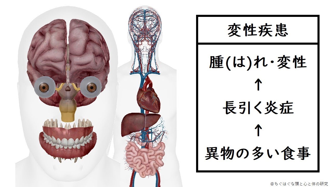 「炎症が長引く食生活で