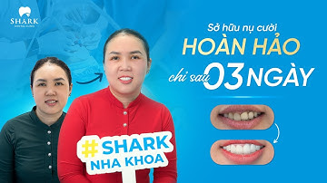 "CHỈ MẤT 3 NGÀY THÔI MÌNH ĐÃ SỞ HỮU ĐƯỢC 1 HÀM RĂNG MÌNH RẤT ƯNG Ý" | CHỊ KIM TUYỀN