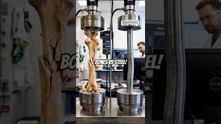 Human Bones Are Stronger Than Steel? 😳| Truth Will Shock You!”