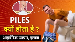 Effective Ayurvedic Treatment for Piles at Home | Natural Remedies Explained