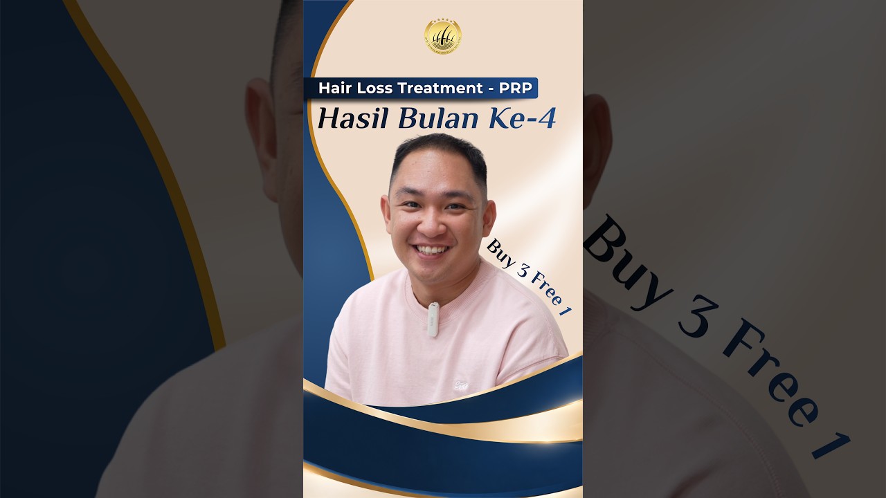 Hair Transplant Malaysia l Pakar Tanam Rambut l Hasil padu gabungan PRP & ubat!