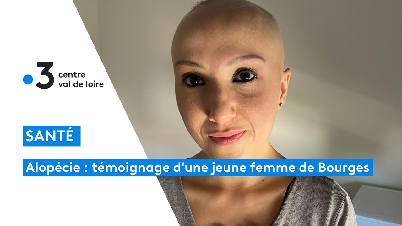 Bourges : témoignage d'une jeune femme atteinte d'alopécie