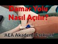 Damar Yolu Nasıl Açılır?