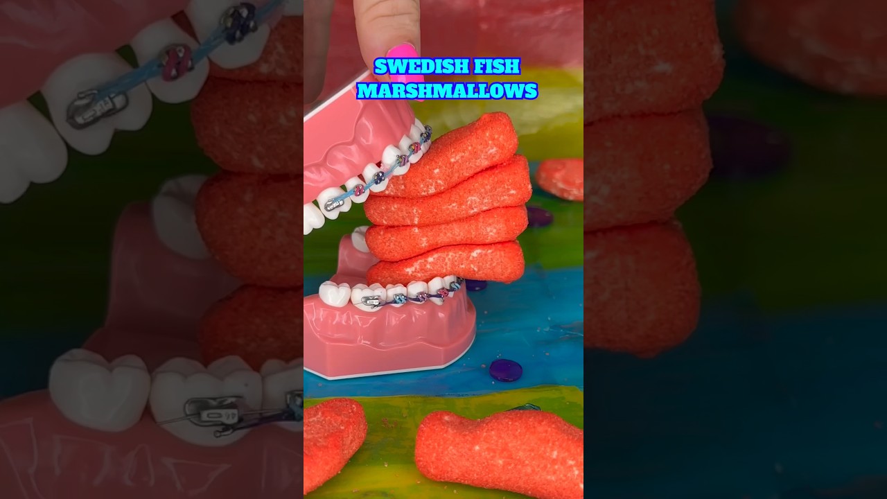 CANDY YOU CAN EAT WITH BRACES 👀 SHARK WEEK 🦈 ORTHODONTIST REACTS