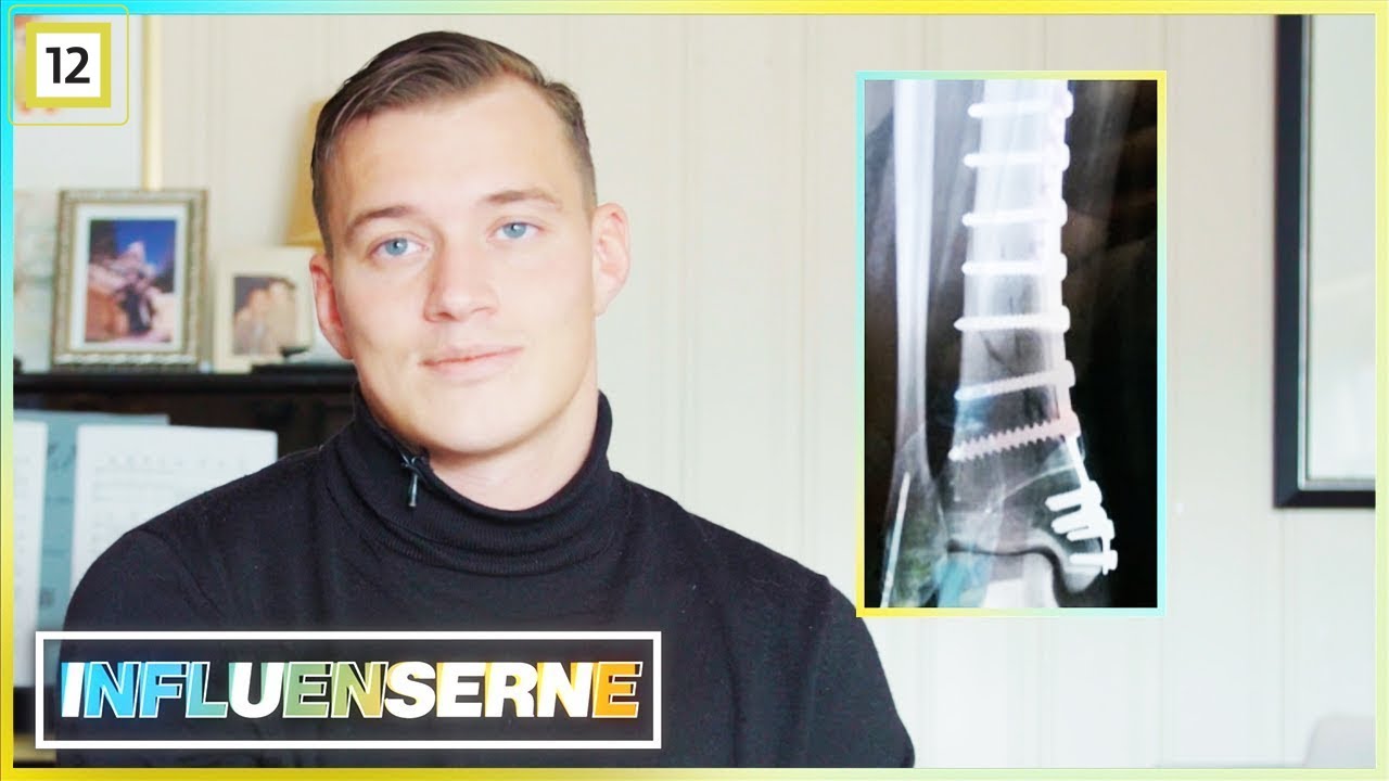 Influenserne | Henrik brakk benet i Thailand | discovery+ Norge
