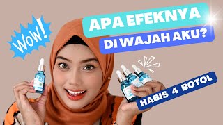 PART 2 ! REVIEW SERUM HANASUI VIT C   COLLAGEN SERUM LOKAL PENCERAH WAJAH HABIS 4 BOTOL,BEFORE AFTER