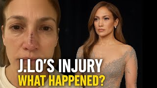 Jennifer Lopez Injured Before Hosting Amas 2025? Fans Shocked By Graphic Nose Sches