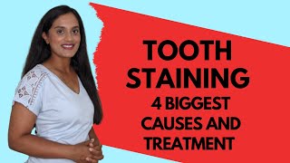 4 BIGGEST CAUSES OF TOOTH STAINING I Dentist's advice on causes and treatment of teeth stains