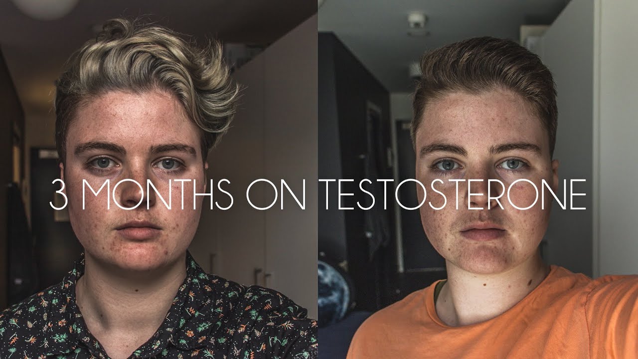 Ab Wann Bekommt Man Testosteron Verschrieben Ftm 3 months on testosterone comparison // FTM transgender - YouTube