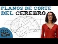 Planos de corte del cerebro