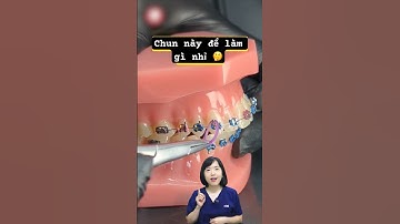 Chun liên hàm khi niềng răng | Dr Anh Thư