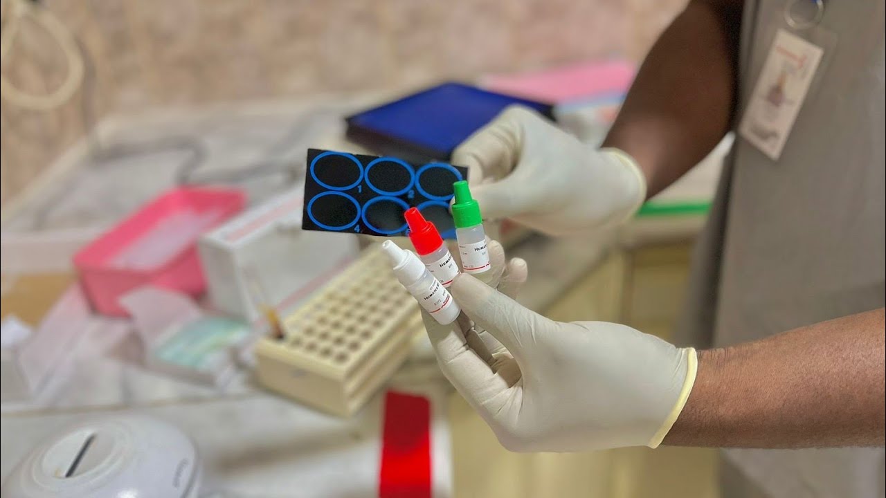 طريقة تحليل اختبار عامل الروماتويد Rheumatoid Factor test في المختبر