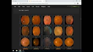 04 Perform Data Augmentation