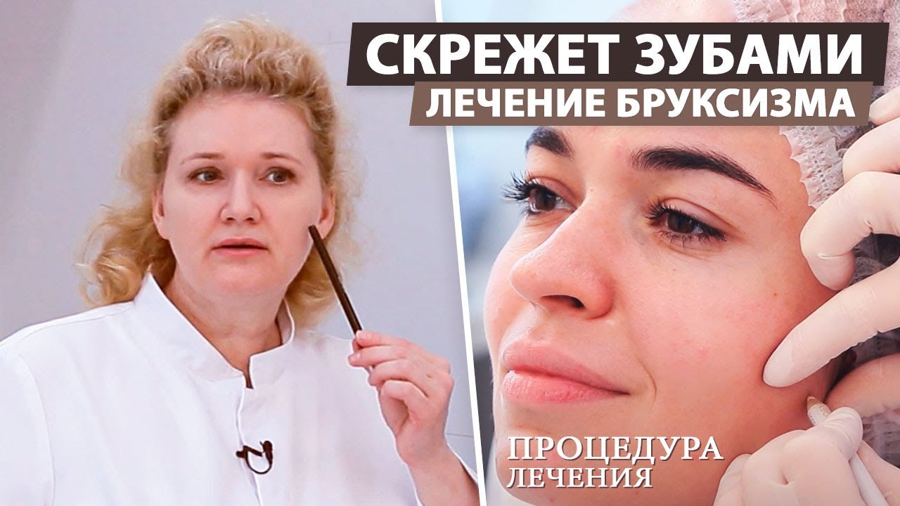 Избавляемся от скрежета зубами. Лечение бруксизма. - YouTube