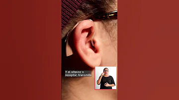 ¿Llevar audífonos es una discapacidad?