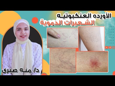 فيديو: ماذا تسأل الرجل: نصيحة للفتيات الصغيرات