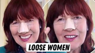 Janet Street-Porter’s Shocking Real Age Revealed Before Surgery Leaves Loose Women Fans Stunned!
