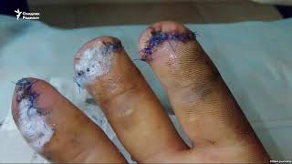 Уч бармоғидан ажралган ўзбек муҳожири ўғирликда айбланди