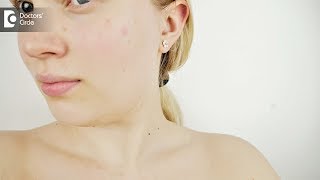 Tips to get rid of open pores in face naturally - Dr. Mini Nair