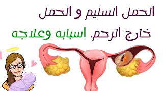 الحمل خارج الرحم. أعراضه، اسبابه وطرق علاجه. الحمل داخل الرحم. أسهل شرح على الإطلاق