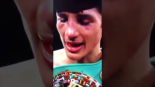 Celebrity Fundora brother & sister champions at the same time #pbcboxing #sebastianfundora #timtszyu #boxeo Profile