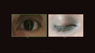 Zero Hallucination (Kernel ZH-81) — Eye Openness Detection v5.0 (4K)