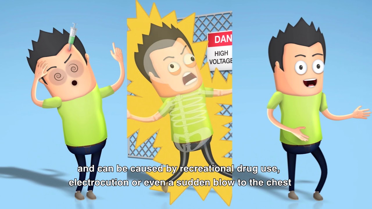 Что такое внезапная остановка сердца?