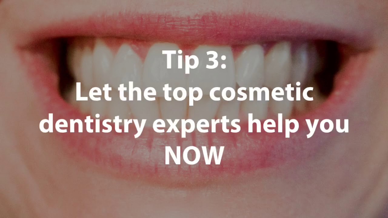 Cosmetic Dentistry Fort Myers Dental Crowns vs Implants YouTube