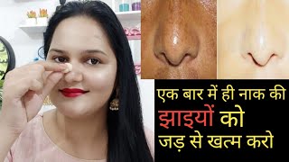 कितनी भी पुरानी नाक की झाइयां Pigmentation जड़ से खत्म करो | How to Remove Pigmentation Naturally