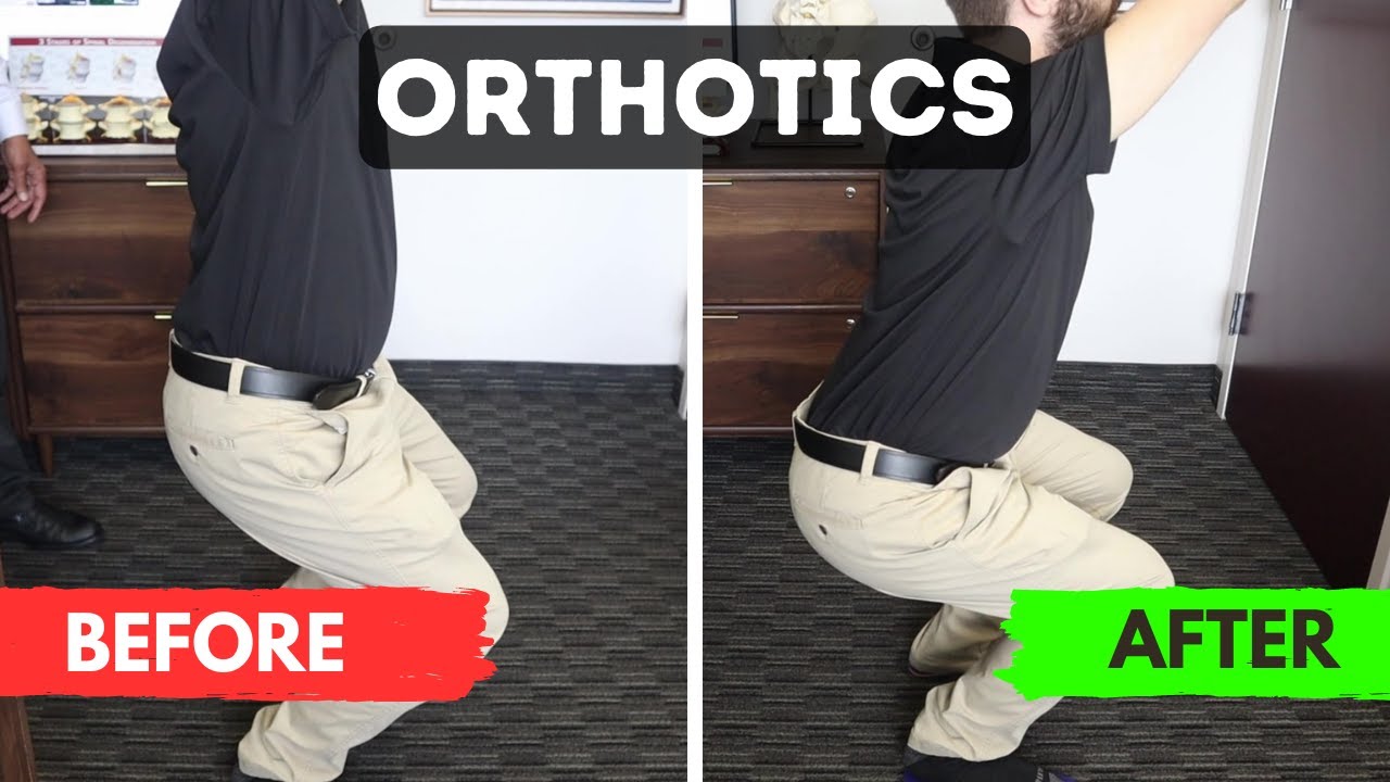 How Orthotics Help You! - Frederick Chiropractor