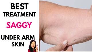 BEST Treatment for Saggy Underarm Skin #batwings #goseechristy