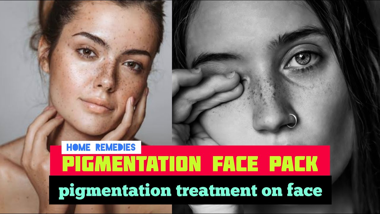 how to pigmentation treatment at homehyper pigmentation face pack at