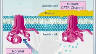 Ion channels and cystic fibrosis