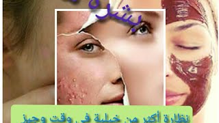 ماسك الإزالة الحبوب و نظارة للوجه 