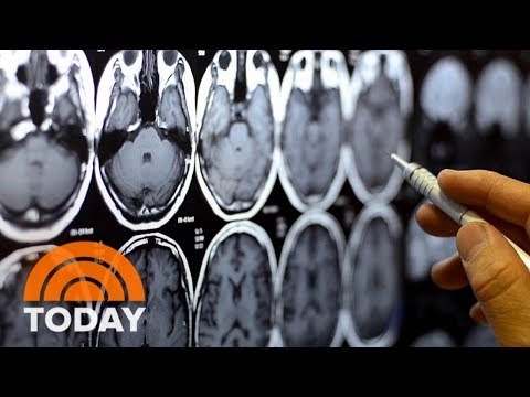 Genetics Determine About Half Of A Person's Predisposition To Addiction | TODAY