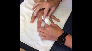 Serial Casting - PIP Joint Stiffness