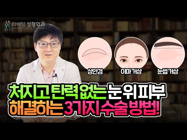 처진 눈 솔루션🤟 눈썹거상 VS 상안검 VS 이마거상 비교분석👩‍🎓