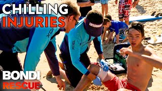 Chilling Injuries from Season 7 of Bondi Rescue by BondiRescue 44,648 views 1 month ago 7 minutes, 23 seconds