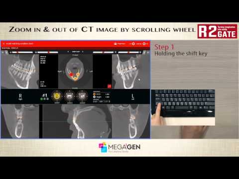 zoom in & out of CT image by scrolling wheel