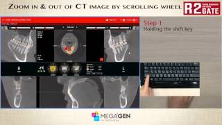 zoom in & out of CT image by scrolling wheel