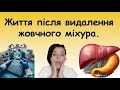 постхолецистектомічний синдром симптоми, лікування. Що робити після видалення жовчного міхура?