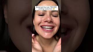 Teeth-whitening hack that guarantees results ✨ asmr trendingproducts teethwhiteningcare