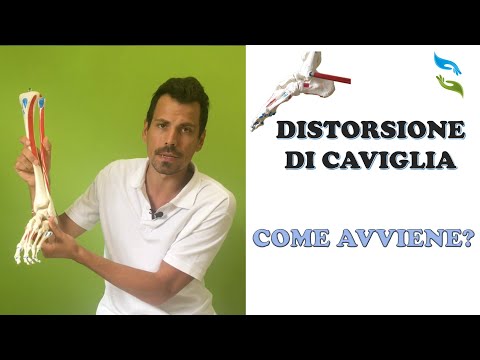 Video: Quando avvolgere una caviglia slogata?