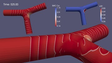 Massively Parallel Arterial Bifurcation Angle Simulation: 100°