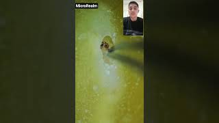 Instant Noodles Under Microscope 😳