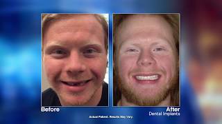 Nobody Should Be Wearing A Loose Denture!