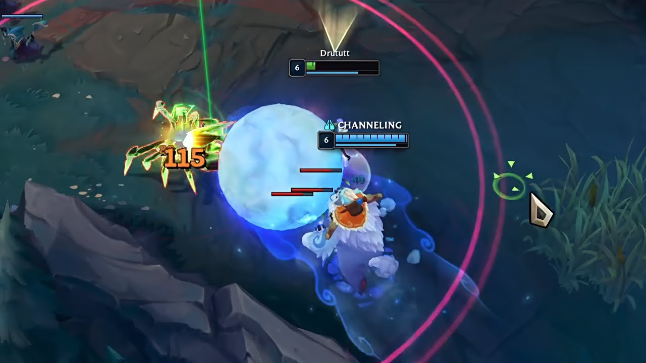 ELISE TOP IS IMPOSSIBLE TO MATCHUP