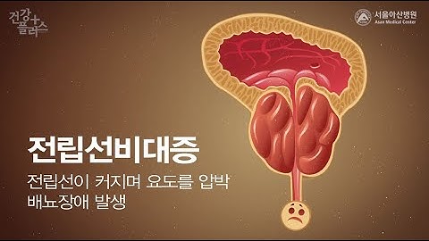 화장실이 두려운 중년남성, 전립선비대증